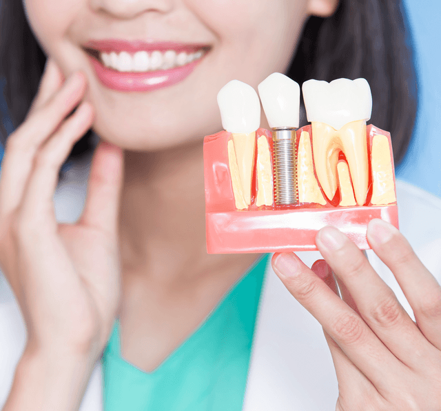 Diş implantasiyası: mərhələlər, göstərişlər və əks göstərişlər